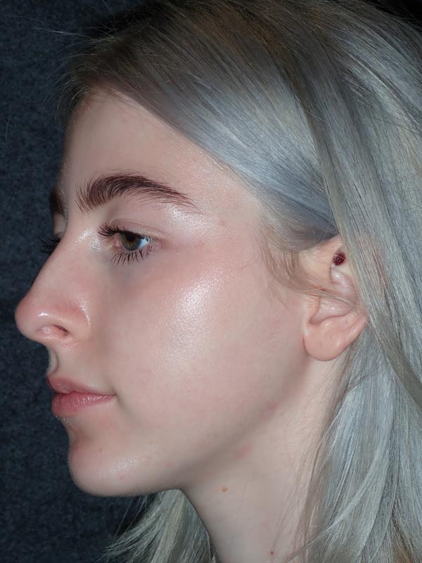 patient after Oral Surgery procedures