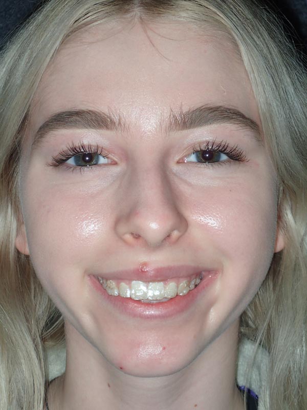 patient before Oral Surgery procedures