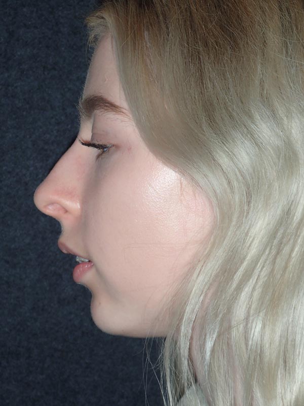 patient before Oral Surgery procedures