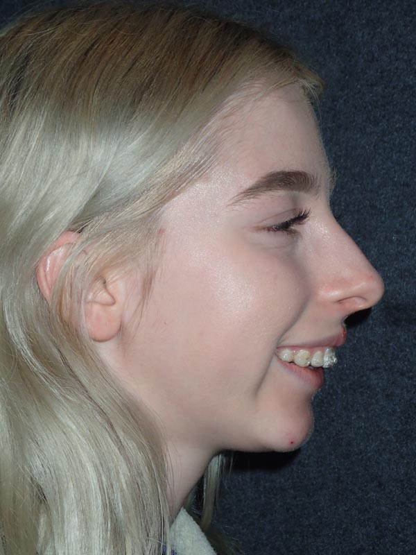 patient before Oral Surgery procedures